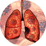 Asthma-COPD overlap