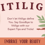 What are the Ways to Prevent Vitiligo?