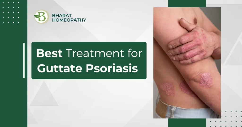 homeopathic treatment for guttate psoriasis