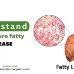 fatty liver homeopathic medicine