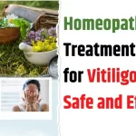 homeopathic treatment for white spots on skin