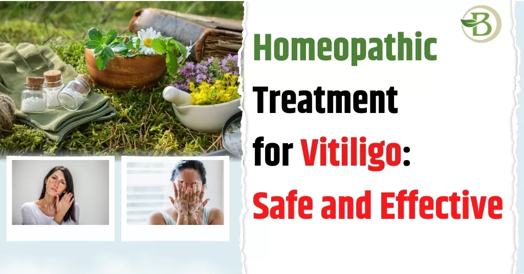 homeopathic treatment for white spots on skin