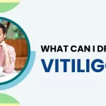 vitiligo homeopathic treatment
