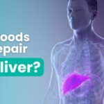 homeopathic treatment for fatty liver