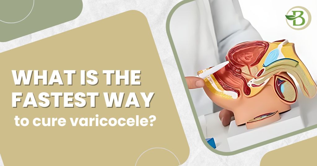 varicocele treatment