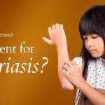 psoriasis