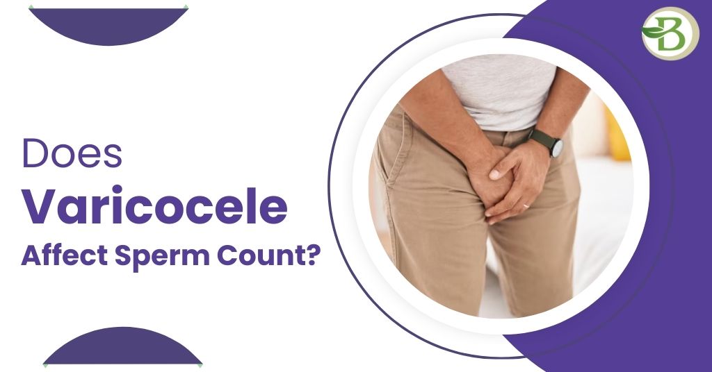 varicocele affect sperm count