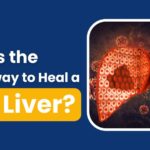 fatty liver treatment