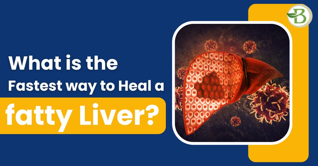 fatty liver treatment