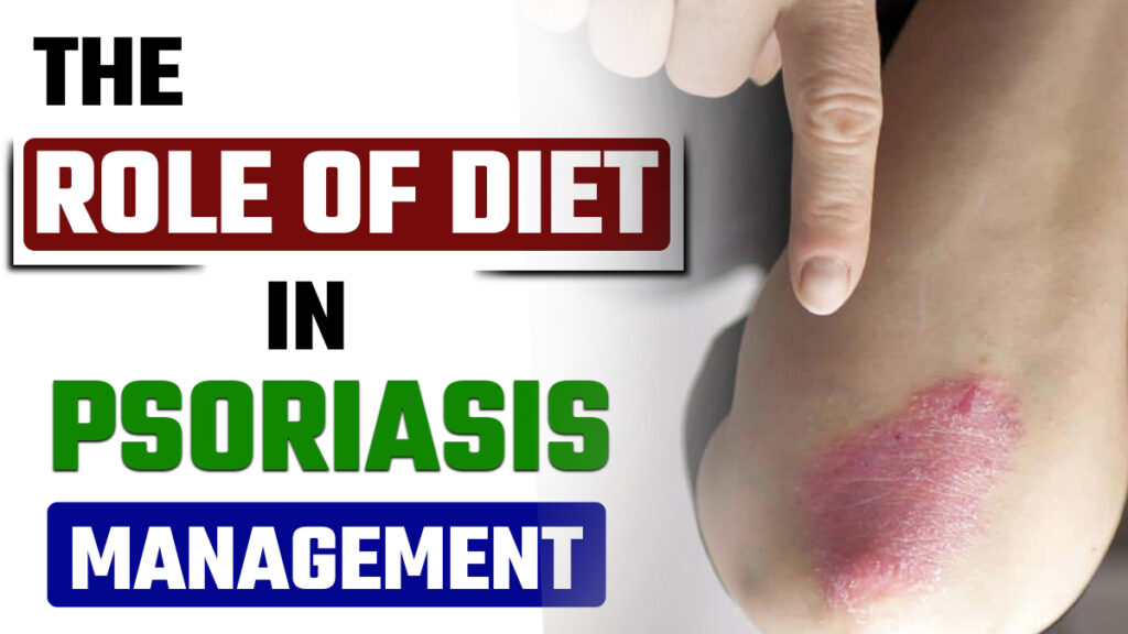 Homeopathic treatment for psoriasis