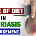 Homeopathic treatment for psoriasis