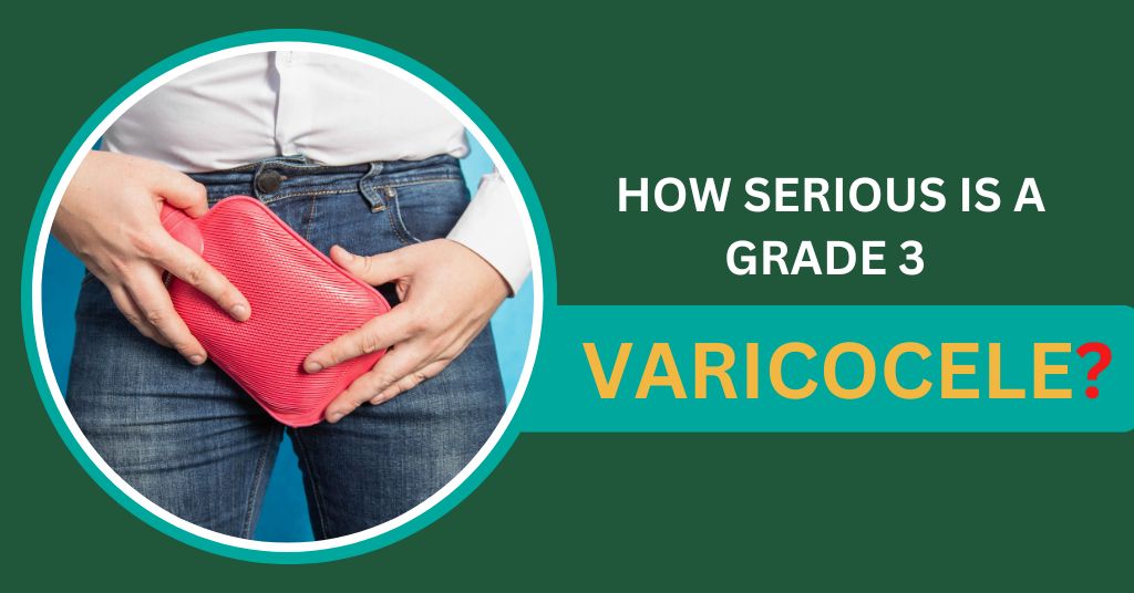 How serious is a Grade 3 varicocele?