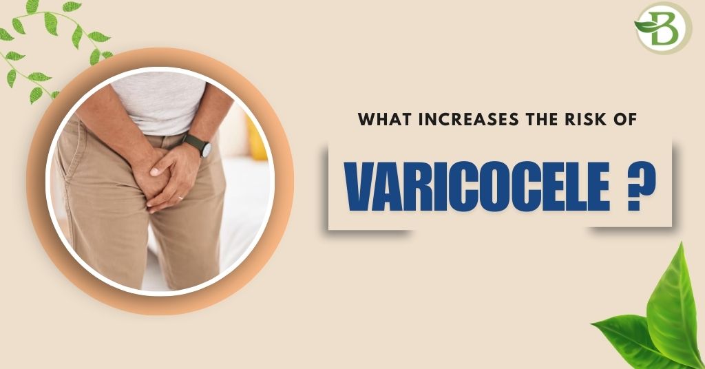 varicocele treatment