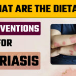 Homeopathic treatment for psoriasis