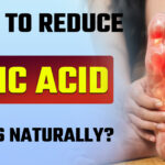 Uric Acid Levels