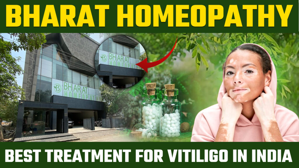 Bharat Homeopathy: Best treatment for vitiligo in India