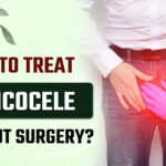 varicocele without surgery