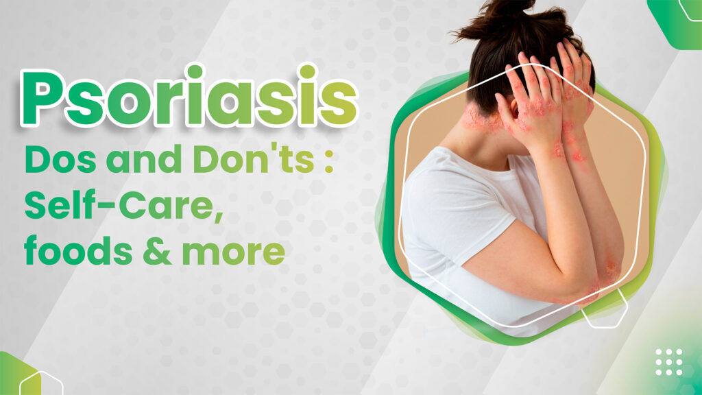 Psoriasis Dos and Don'ts: Self-Care, foods & more