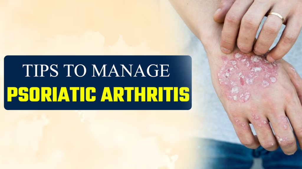 Tips to manage Psoriatic Arthritis