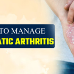 Tips to manage Psoriatic Arthritis