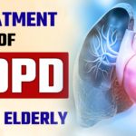 Treatment of COPD