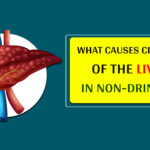 What causes cirrhosis of the liver in nondrinkers?