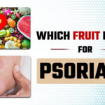 best fruit for psoriasis