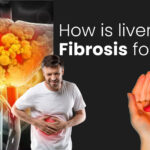 How is liver fibrosis formed?