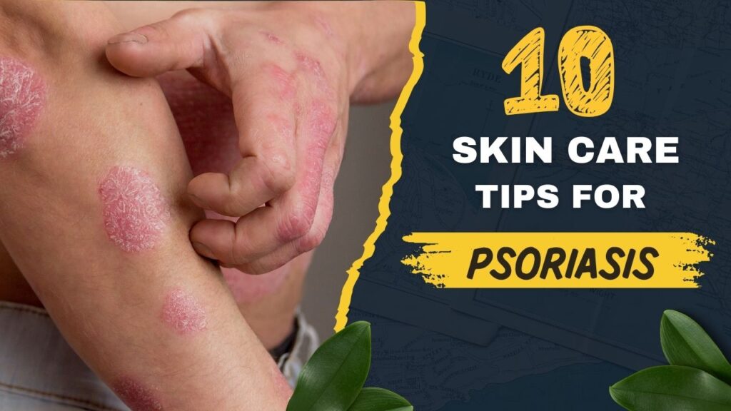 10-skin-care tips for psoriasis