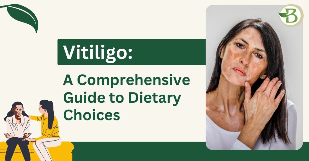 Vitiligo: A Comprehensive Guide to Dietary Choices