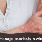 7 Tips to manage psoriasis in winter