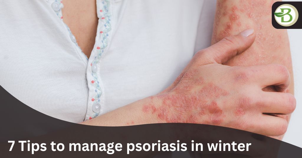 7 Tips to manage psoriasis in winter