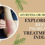 Ayurveda or Homeopathy: Explore the best psoriasis treatment in India