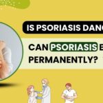 Is psoriasis dangerous? Can psoriasis be cured permanently?