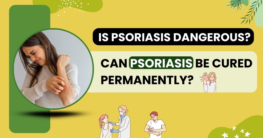 Is psoriasis dangerous? Can psoriasis be cured permanently?
