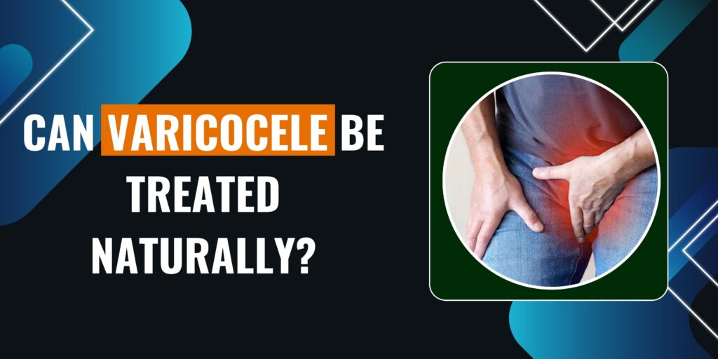 Can varicocele be treated naturally?