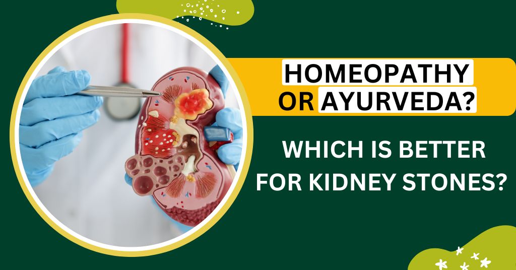 Homeopathy or Ayurveda? Which Is Better For Kidney Stones?