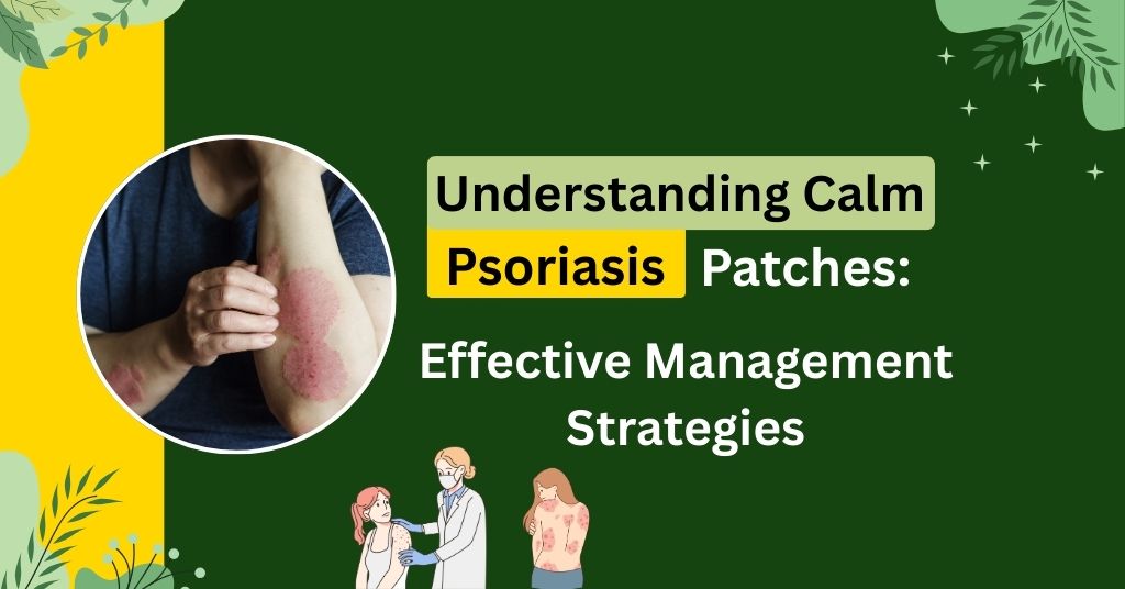 Understanding Calm Psoriasis Patches: Key Factors & Effective Management Strategies