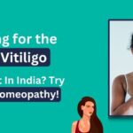 Looking for the Best Vitiligo Treatment In India? Try Bharat Homeopathy!