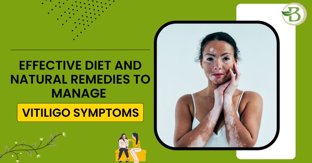 Effective Diet and Natural Remedies to Manage Vitiligo Symptoms