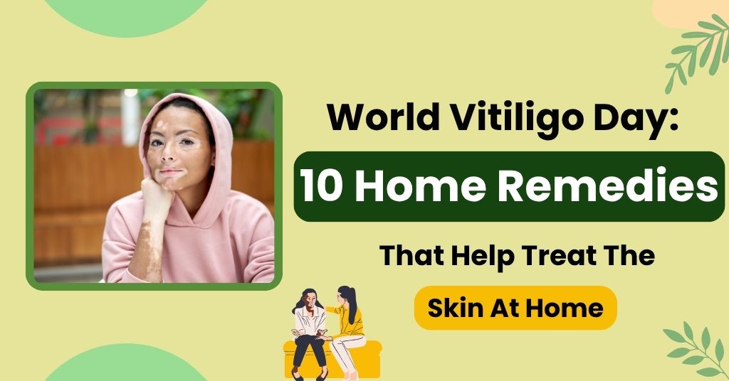 World Vitiligo Day: 10 Home Remedies That Help Treat The Skin At Home