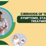 Cirrhosis of the Liver: Symptoms, Stages, and Treatment