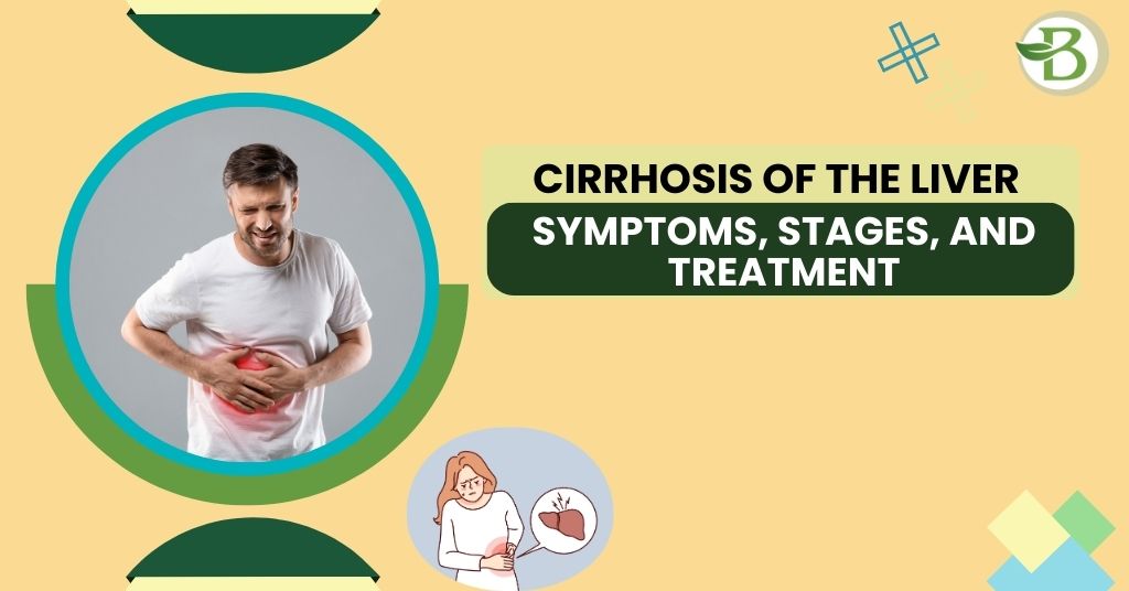 Cirrhosis of the Liver: Symptoms, Stages, and Treatment