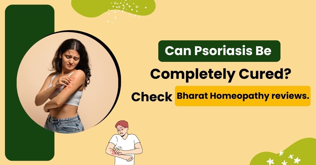 Can Psoriasis Be Completely Cured? Check Bharat Homeopathy reviews.