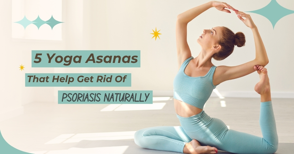 5 Yoga Asanas That Help Get Rid Of Psoriasis Naturally
