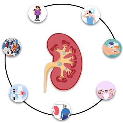 Causes of Kidney Stone