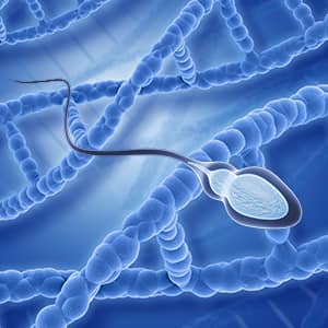 Sperm DNA Damage