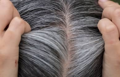 Premature greying or whitening of the hair